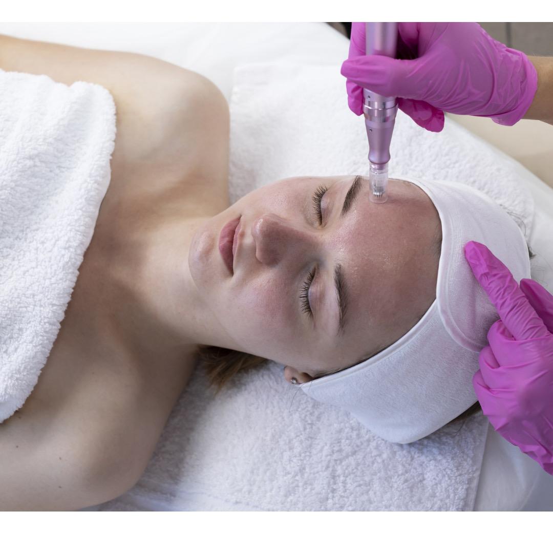 MicroNeedling Service